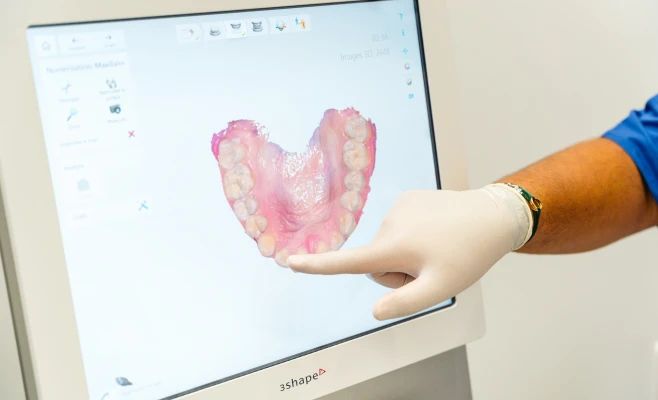 Empreinte optique au cabinet d'orthodontie des Bruyères des Docteurs Benichou & Nizard à Bois-Colombes